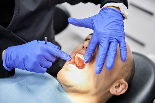 Best Emergency Tooth Extraction in Oak Harbor, OH