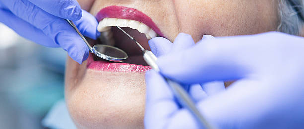 Best Walk-In Emergency Dentist in Oak Harbor, OH